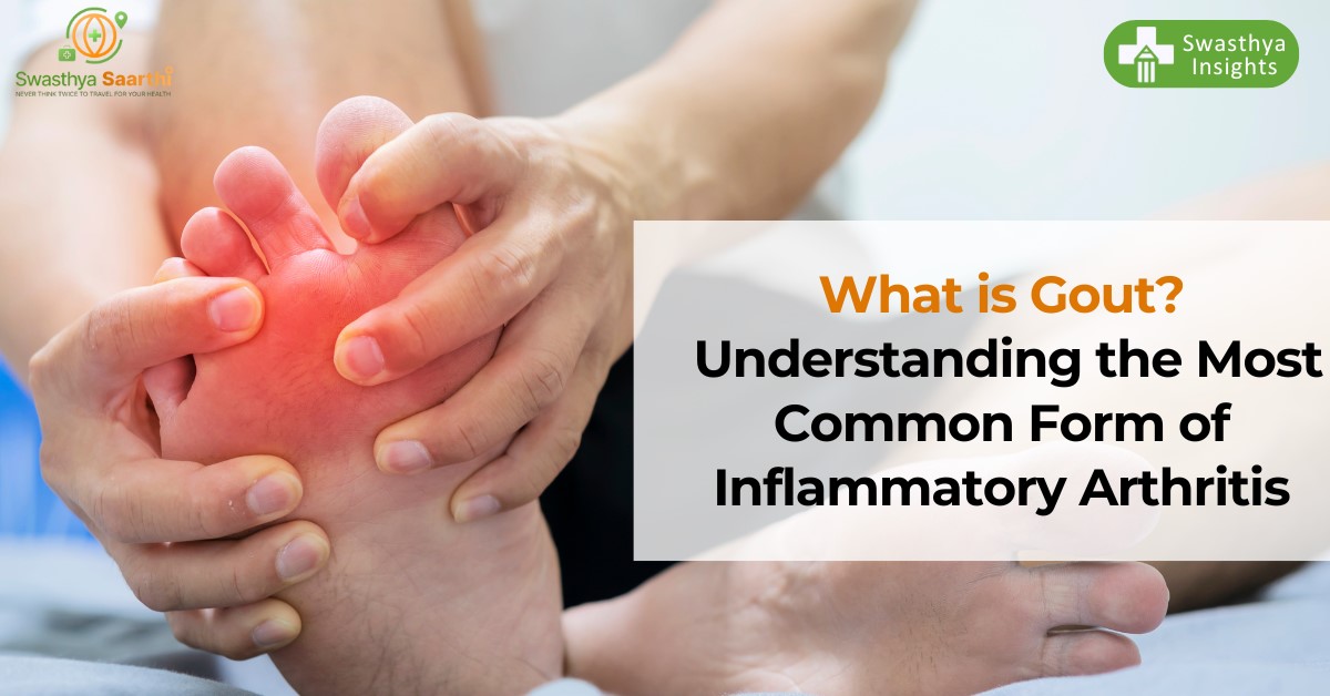 What is Gout Disease? Understanding the Most Common Form of Inflammatory Arthritis